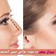 جراحی بینی استخوانی