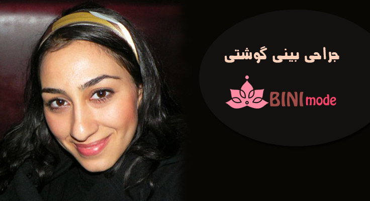 جراحی بینی گوشتی