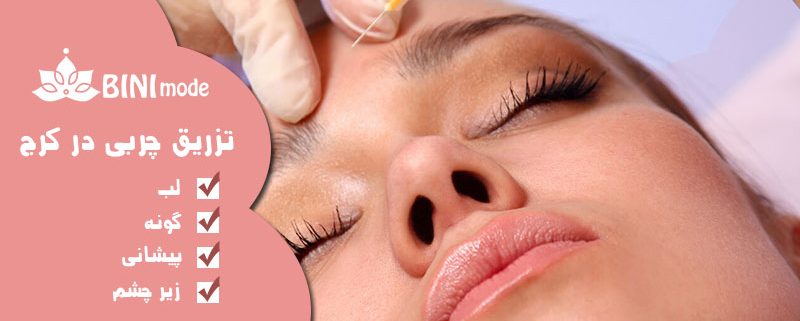 تزریق چربی در کرج