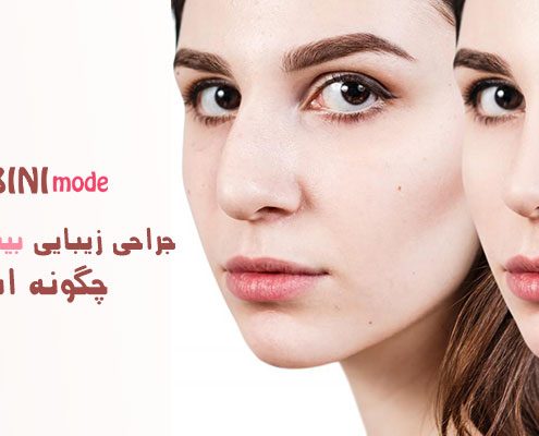 جراحی زیبایی بینی خیلی بزرگ