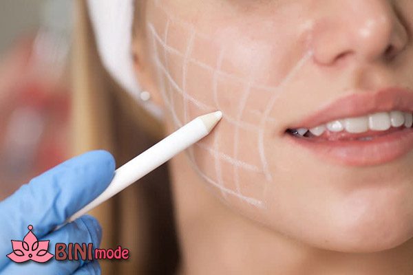 آیا تزریقاتی که برای زاویه سازی فک انجام میشود عوارضی دارد؟