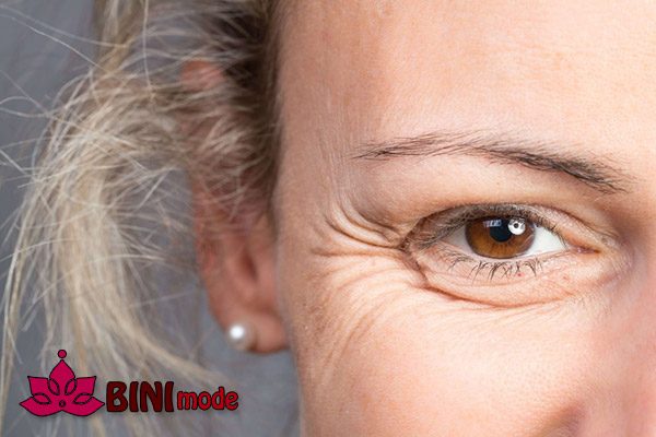 تزریق ژل برای خطوط دور چشم