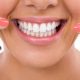 سفید کردن دندان