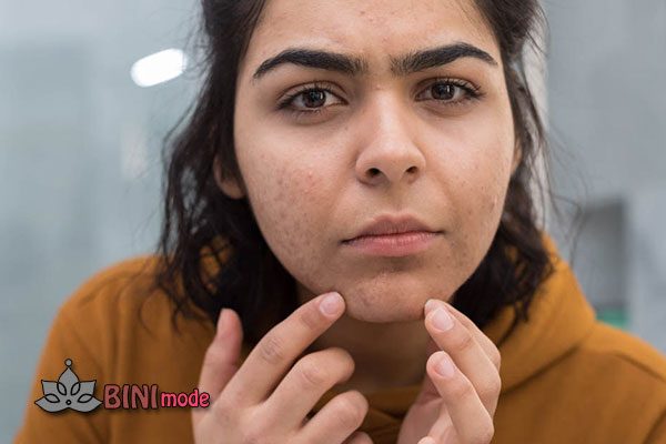 چرا پر مو میشویم؟