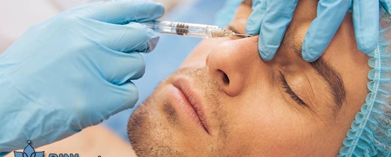 بوتاکس پیشانی در آقایان