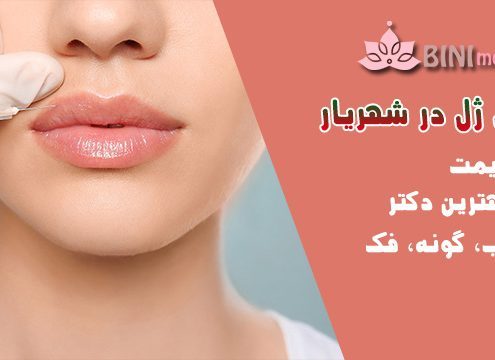 تزریق ژل در شهریار