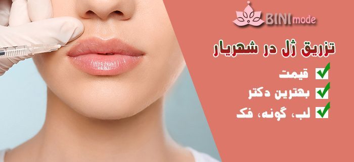 تزریق ژل در شهریار