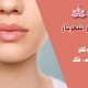 تزریق ژل در شهریار