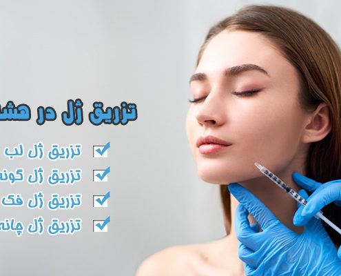 تزریق ژل در هشتگرد