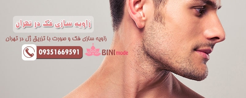 زاویه سازی فک در تهران