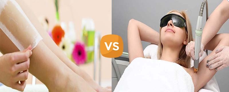 لیزر موی زائد یا اپیلاسیون