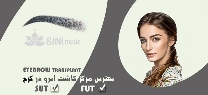 کاشت ابرو در کرج
