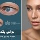 جراحی پلک در کرج