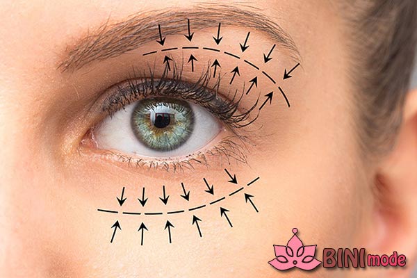 جراحی پلک یا بلفاروپلاستی به چه صورتی انجام میشود ؟