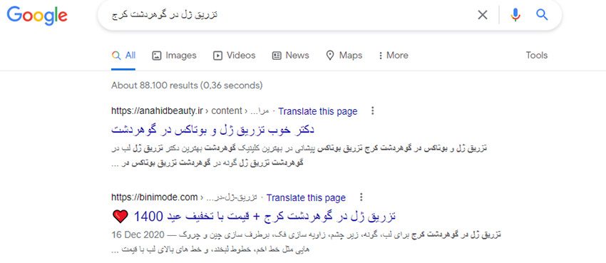 سئو سایت تزریق ژل در گوهردشت کرج