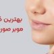 کرم موبر صورت خارجی
