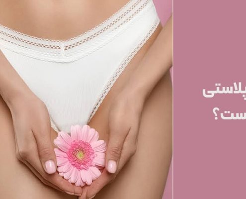 لابیاپلاستی چیست