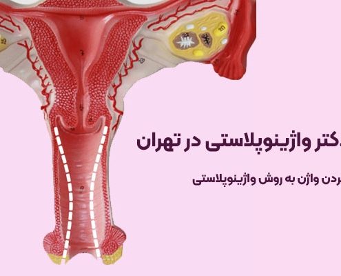 بهترین جراح واژینوپلاستی در تهران
