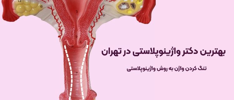 بهترین جراح واژینوپلاستی در تهران