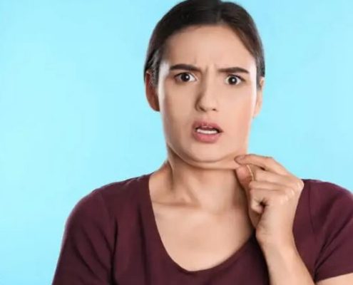 روش خانگی رفع غبغب