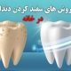 سفید کردن دندان در خانه