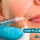 عوارض تزریق ژل به صورت