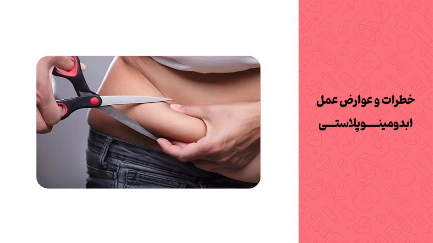 خطرات و عوارض عمل ابدومینوپلاستی