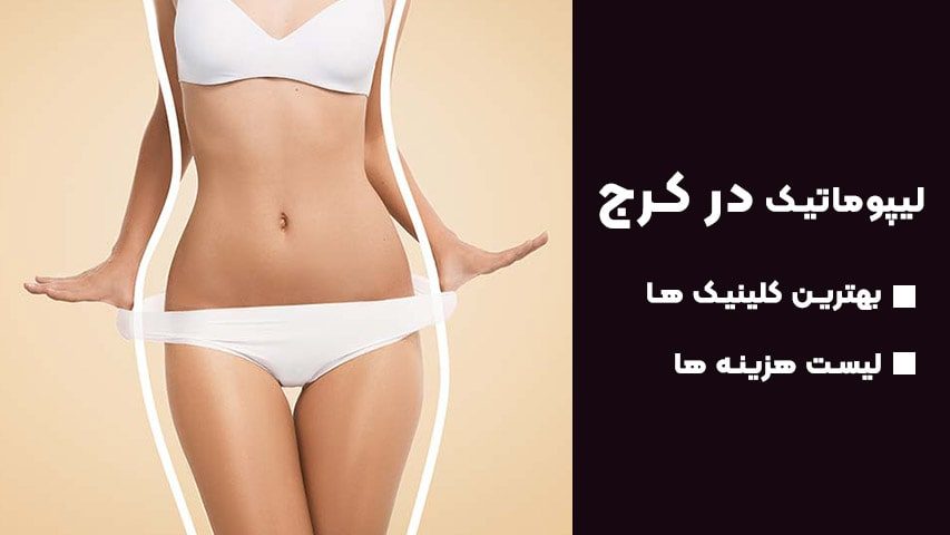 لیپوماتیک کرج