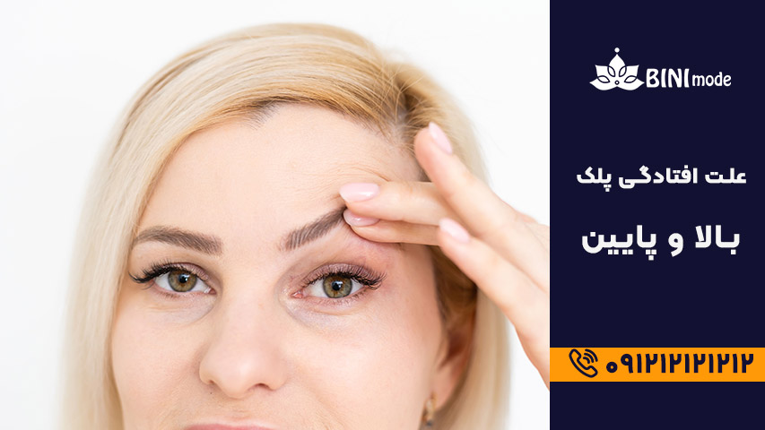 دلیل افتادگی پلک چیست؟