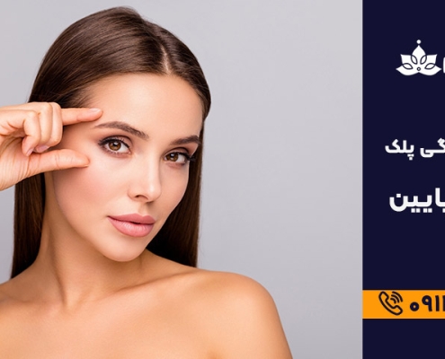 علت افتادگی پلک