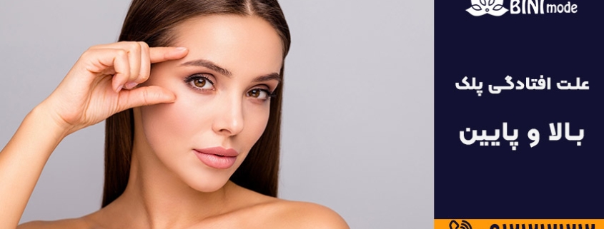 علت افتادگی پلک