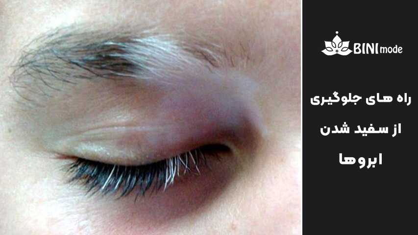 سفید شدن ابرو