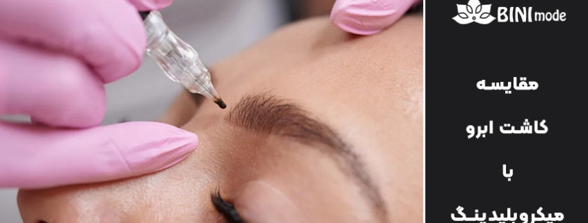 مقایسه میکروبلیدینگ با کاشت ابرو