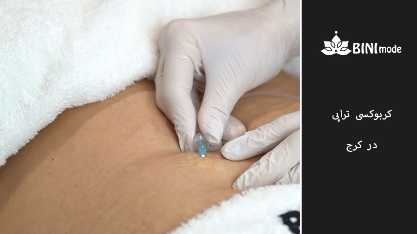 کربوکسی تراپی چیست؟