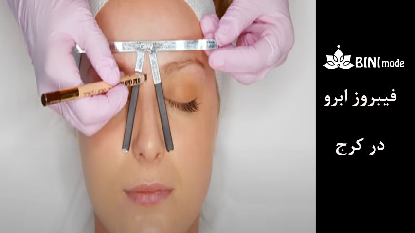 فیبروز-ابرو-11