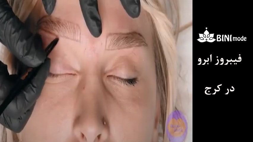 فیبروز-ابرو-12