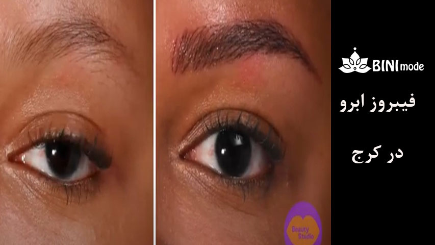 فیبروز-ابرو-14