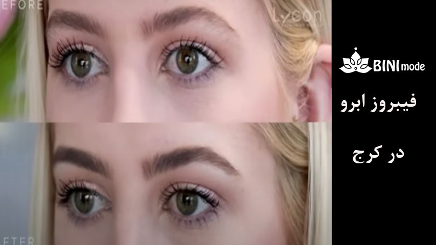 فیبروز-ابرو-15