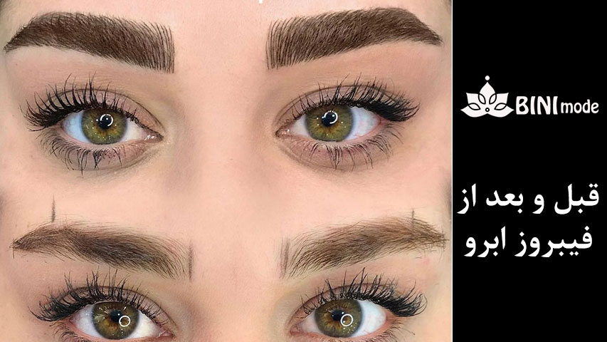 قبل و بعد فیبروز کرج 6