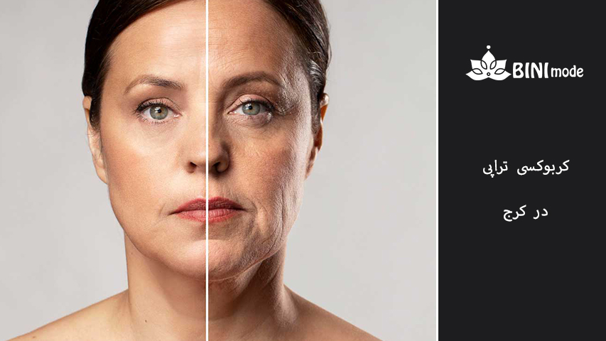 کاربرد های کربوکسی تراپی