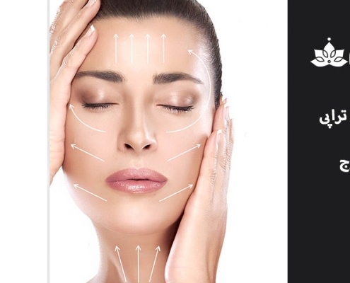 کربوکسی تراپی در کرج