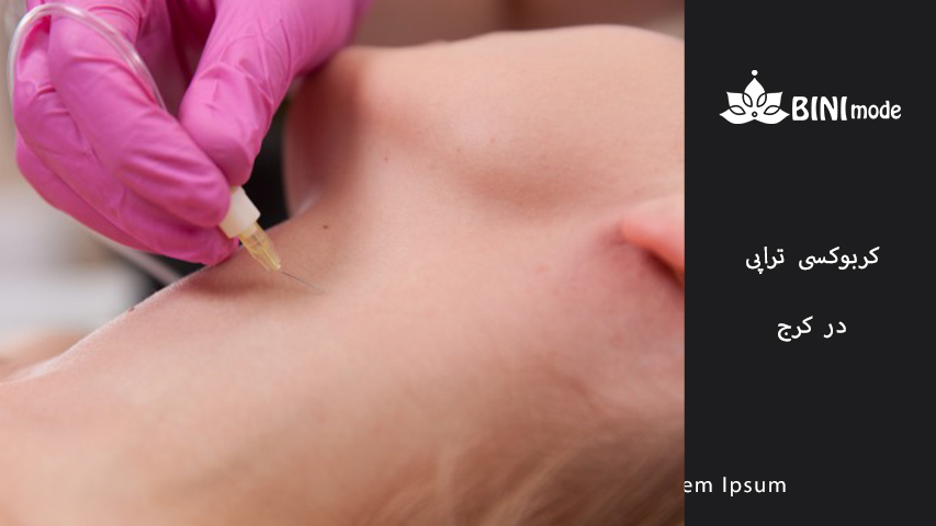 مزایای کربوکسی تراپی