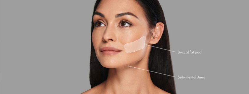 مراقبت بوکال فت