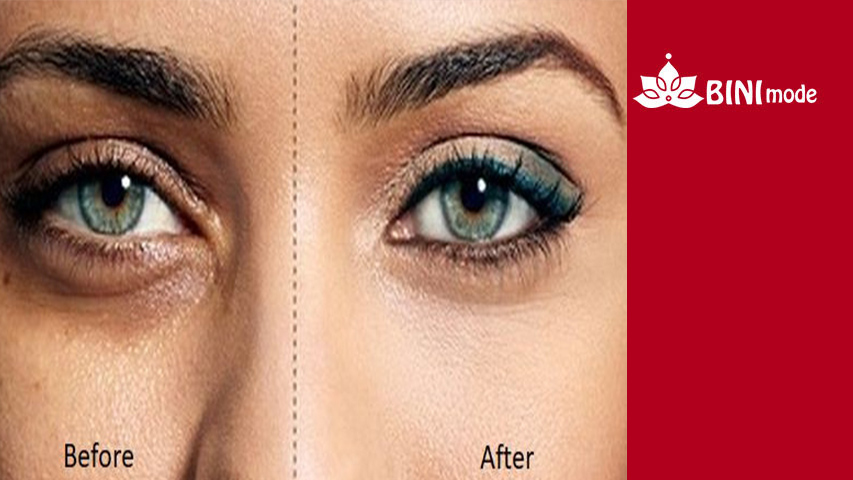 کاهش-تیرگی-و-پف-چشم