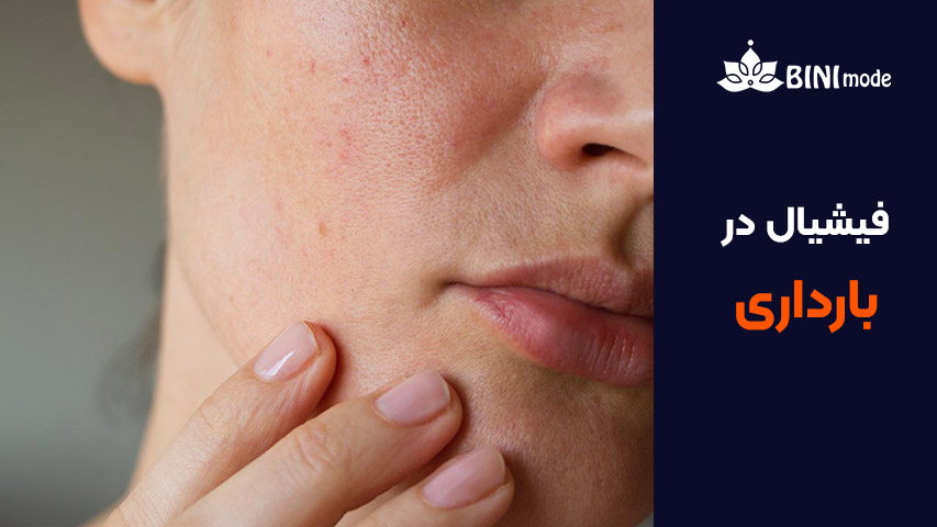 فیشیال بارداری