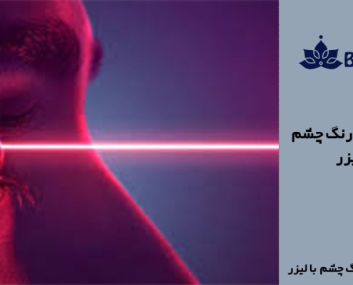 لیزر تغییر رنگ چشم