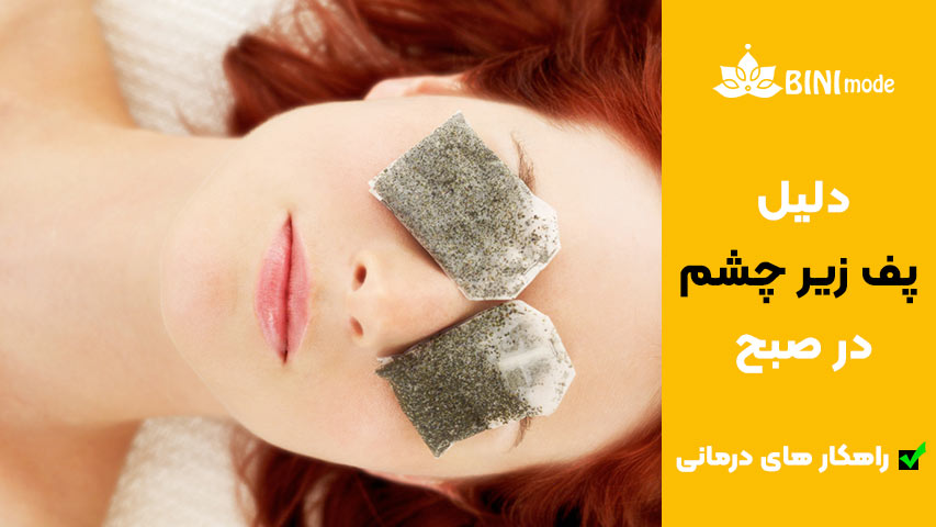 درمان پف زیر چشم در صبح