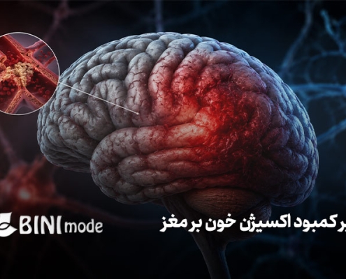 تاثیر کمبود اکسیژن خون بر مغز