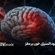تاثیر کمبود اکسیژن خون بر مغز