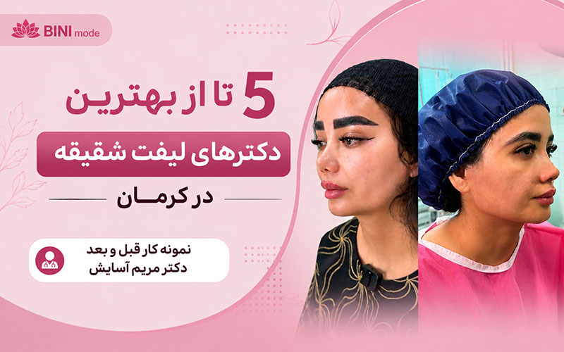 بهترین دکتر لیفت شقیقه کرمان
